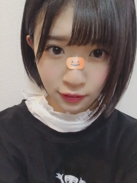 松田 好花｜私のあげたカチューシャが、、（2018-11-03）｜2枚目