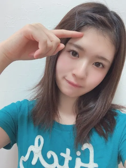 松田 好花｜今日は水ぶくれ記念日（2020-05-12）｜2枚目