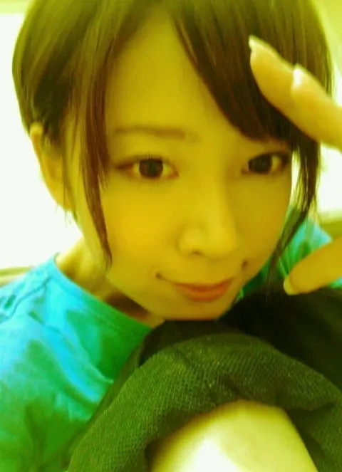 橋本 奈々未｜(´_ゝ｀) 虫さされアレルギー（2012-08-05）
