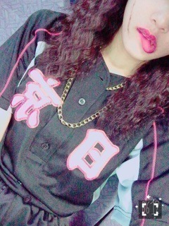 伊藤 純奈｜♯77個目  傷だらけ のローラ（2015-07-27）｜2枚目