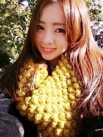 川村 真洋｜バッグ持ちすぎて 肩擦り むいてた(°Д°) 絆創膏 貼ってみた☆ひゃひゃひゃっ Rotty ♪（2013-12-06）｜2枚目