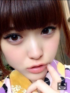 松村 沙友理｜口角炎ができたっ(o ・・o)（2014-07-18）｜13枚目