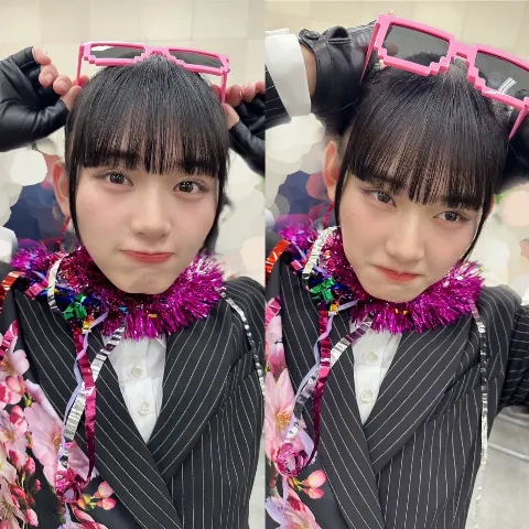 山﨑 天｜久しぶり！！てんちゃんだよ！！（2024-03-06）｜25枚目