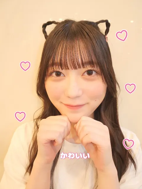 山﨑 天｜みんな可愛すぎてずっと撮っていられる（2024-08-22）｜11枚目