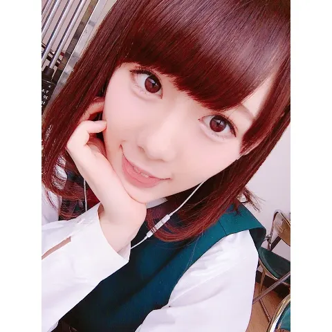 小池 美波｜噛まれた。（2017-05-09）｜2枚目