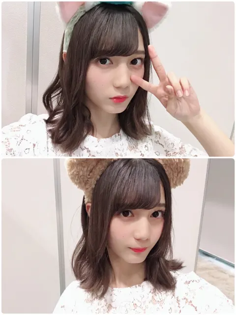 小坂 菜緒｜ものさしを買って袋から出す時に勢いで指を切ってしまって次の日…（2018-07-17）｜4枚目
