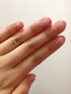 伊藤 寧々｜ねねころぐ(´･_･`)＊102（2012-05-12）｜10枚目